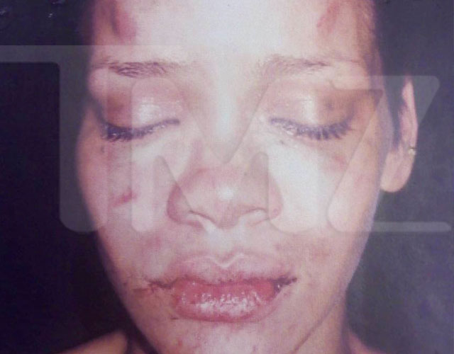 Rihanna after the beating